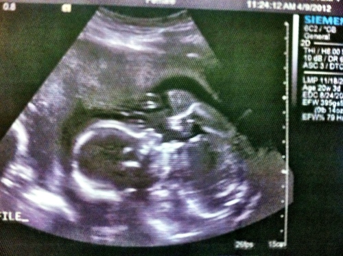 Our active little blessing!  Baby H